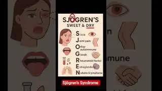 Sj&ouml;gren&rsquo;s Syndrome Memory Trick 💡 | Never Forget #THEDENTEDGE