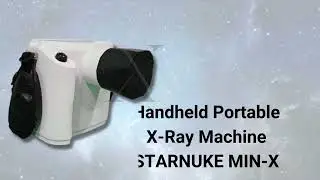 Top X-Ray Machines in India: Best Choices for 2025|| XRAY NEWS