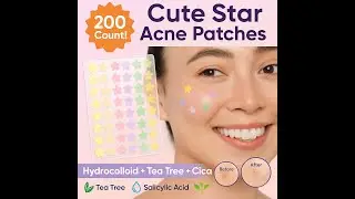 Cute Star Pimple Patches &ndash; 200 Hydrocolloid Acne Stickers with Tea Tree, Salicylic Acid & Cica
