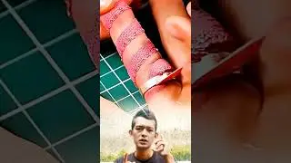 How to Remove a Stuck Ring Easily Using Cloth or String #short #shorts #shortvideo #creative