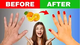 Expert Tips: How to Get Beautiful Hands in Cold Weather | Best Remedy for Dryness and Wrinkles