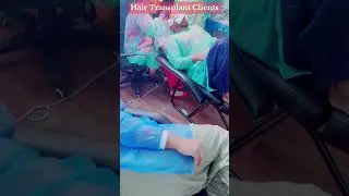 #hairtransplant #hairresturation #fuemethod #sapphire #bestresults #naturallook #rajpootaesthetics