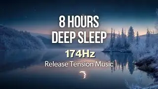 8 HOURS DEEP SLEEP: 174Hz Healing Frequency ∣ Release Tension Music