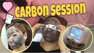MY CARBON FACIAL LASER SESSION EXPERIENCE #goodforscar #selflove #pampering