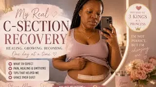 Postpartum C-Section Recovery #csection #postpartum #childbirtheducation #baby #newborn 