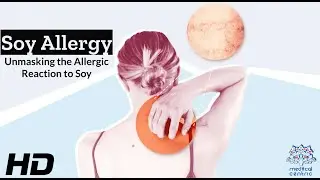 Beyond Tofu: Understanding the Soy Allergy Spectrum