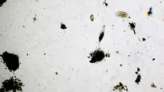 Bdelloidea Rotifera