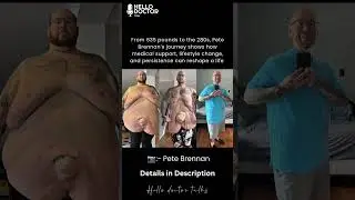 From 635 pounds to the 280s, Pete Brennan&rsquo;s journey shows how medical support, lifestyle change.