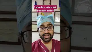 3 STEPS FOR A NATURAL HAIR TRANSPLANT HAIRLINE