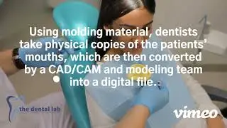 What are Digital Dentures?