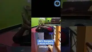 1 Month Recovery after ACL Surgery with FiberTape Internal Brace, Pt. Shubham from Maharashtra