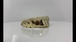 Top 10 Grillz in 10K Yellow Gold - 100% Authentic Gold Teeth | Luxe Grillz
