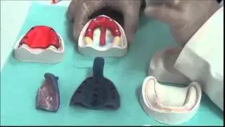 006 Complete dentures: LAB1-  Special Tray