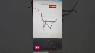 Adani Buy कब करें 🤑😱✅ #shorts #shortsfeed #adani