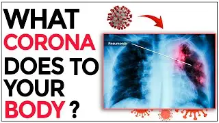 What happens to your body when you get Coronavirus?