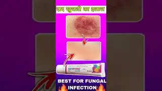 Fourfight Cream | Best Antifungal & Anti-Itching Cream Uses, Benefits & Side Effects
