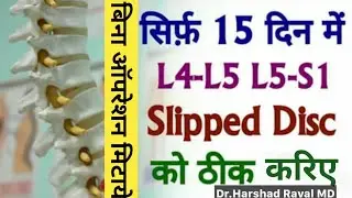 L4 L5 Slip Disc l Herniated Disc l Disc Protruded l Disc Extrusion बिना ऑपरेशन 100% मिटाये कमर दर्द