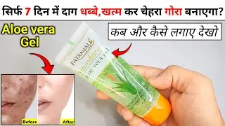Aloe vera gel for face | patanjali saundarya aloe vera gel review | aloe vera gel