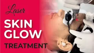 Unlock Radiant Skin with Skin Glow Laser Treatment | Transform Your Complexion | Sakhiya Skin Clinic