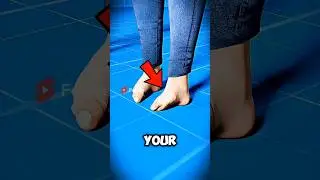 Никогда так не сгибайте ноги! Иначе пожалеете! 🦵😱