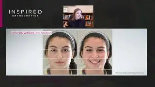 Orthodontic Goals | Dr. Rebecca Bockow