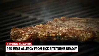 Red meat allergy from tick bite turns deadly
