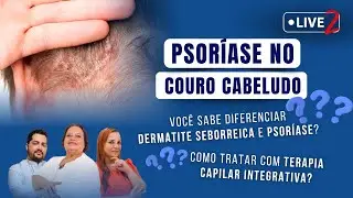 PSORÍASE no COURO CABELUDO - Saiba diferenciar Dermatite e Psoríase e como Tratar c/ Terapia Capilar
