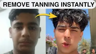 HOW TO REMOVE SUN TAN FAST |PRECAUTIONS | NATURAL REMEDIES |EVERYTHING ABOUT TANNING |