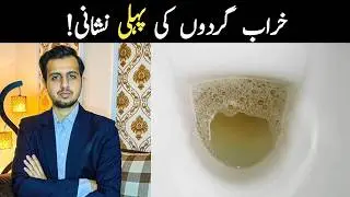 خراب گردوں کی پہلی نشانی| The First Sign Of Kidney Disease 