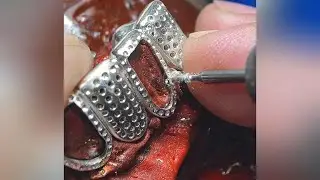 Unleash your daring side with our open-face grillz! #grillz #customgrillz #openfacegrillz #icedout