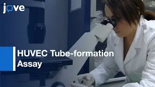 HUVEC Tube-formation Assay in Angiogenesis | Protocol Preview