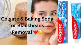 Colgate and Baking Soda for Blackheads Removal | Best Toothpaste Beauty Hacks for Skin Problems
