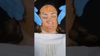 Effect of Algae Peeling by ZENA