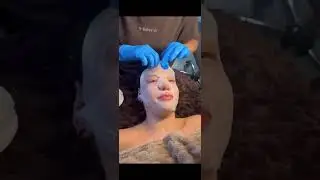 Cliniccare luxury dermaplanning facial