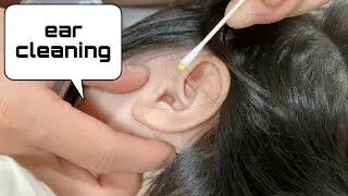#58🇻🇳3 year old ear cleaning