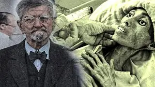 The HORRIFYING Professor From The Dachau Camp: Inhumane Human Experimentation By Klaus Schilling