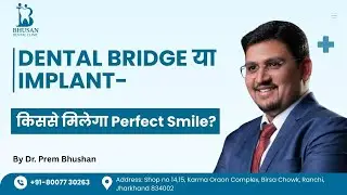 Missing Tooth? | Dental Bridge vs Dental Implant | कौन सा है आपके लिए Best Option?
