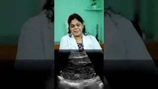 What is NIPT, or Non-Invasive Prenatal Testing? | Sabine Hospital
