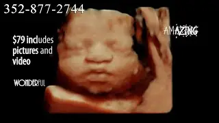 SonoSmile 3D ultrasound Ocala Florida