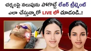 Best Laser Treatment for Pigmentation on Face || Laser Treatment for Dark Spots on Face || Skin Care