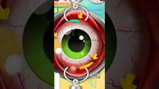 Eyes Clean in Er hospital Surgery All level mobile iOS Android game walkthrough [LIZARD GAMING]