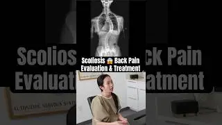 Лечение сколиоза с помощью хиропрактики Гонстеда | Ведение пациентов д-ра Рахима #шорты