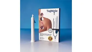 Hur du enkelt och snabbt tar bort hudflikar med TagMole!