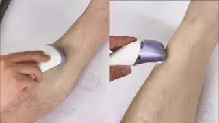 VOYOR Epilator for Women, 3 in 1 Epilator Hair Removal for Women Rechargeable & Cordless BM300