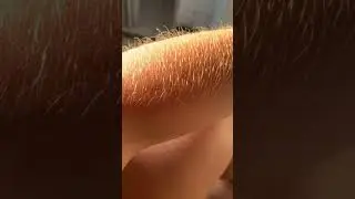 Arm Hair #hairyarms #armhair #Shorts #bleaching #bleach #bodyhair