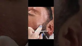 Как ботокс помогает при мигрени?