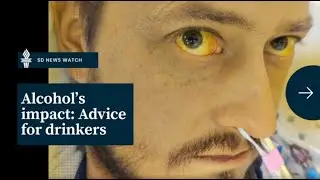 Alcohol's impact: Advice from a man dying from liver failure