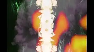MINDSTORM [excerpts]  4.20