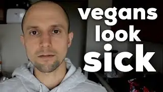 Why Do Vegans Look Sick | Vegans Are Malnourished?