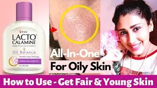 Best Face Cream for Oily Skin🌿 Face glowup Cream for acne prone Pimples dark spots ✨ Lacto Calamine
